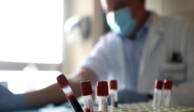No vax al ministero, destra divisa: Schillaci minaccia le dimissioni - la Repubblica