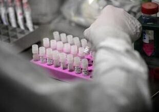 Covid Casi in Aumento a Luglio Anche il Sars Cov 2 ha Rialzato la Testa