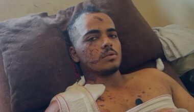 Jamal Badah, il fotografo sopravvissuto alla strage all'ospedale Nasser a Gaza: «Quando mi sono ripreso, tutti intorno a me erano morti. Nessuno si aspettava un secondo attacco»