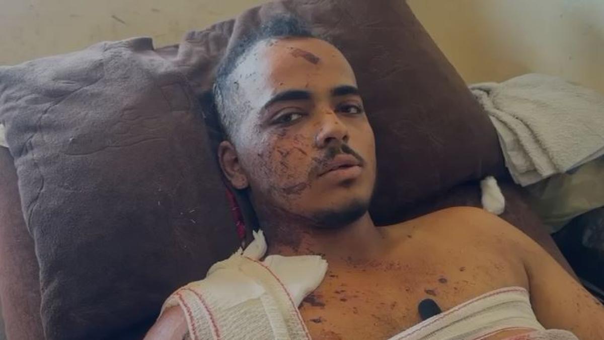 Jamal Badah, il fotografo sopravvissuto alla strage all'ospedale Nasser a Gaza: «Quando mi sono ripreso, tutti intorno a me erano morti. Nessuno si aspettava un secondo attacco»