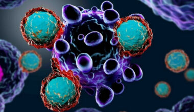 SLA, scoperta a Torino: proteine nel sangue permettono diagnosi precoce e nuove possibilità di cura