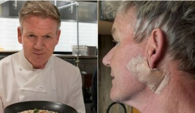 Gordon Ramsay scopre un tumore alla pelle sul collo: «Mi sono operato, usate sempre la crema solare». E mostra la cicatrice - Il Messaggero