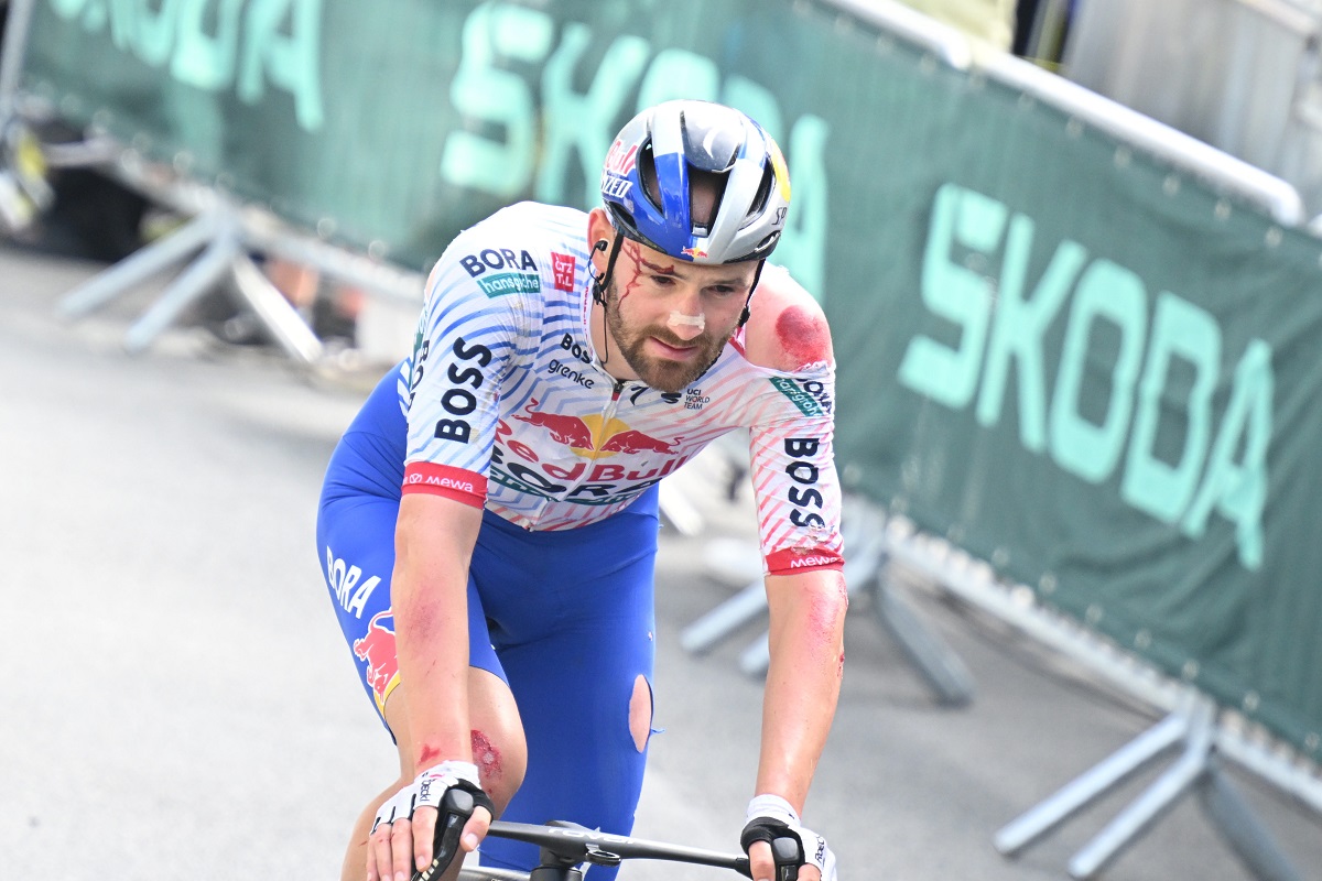 Red Bull-Bora-hansgrohe, Jordi Meeus ancora alle prese con le ferite rimediate al Tour: "La doccia è il momento più doloroso della giornata"