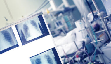L'Università di Bari chiude il corso di laurea per Tecnici di radiologia. La FNO TSRM e PSTRP: a rischio la tenuta del SSN - TrendSanità