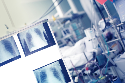 L'Università di Bari chiude il corso di laurea per Tecnici di radiologia. La FNO TSRM e PSTRP: a rischio la tenuta del SSN - TrendSanità