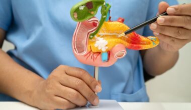 Un vaccino per prevenire le recidive nel tumore del pancreas - Fondazione Umberto Veronesi