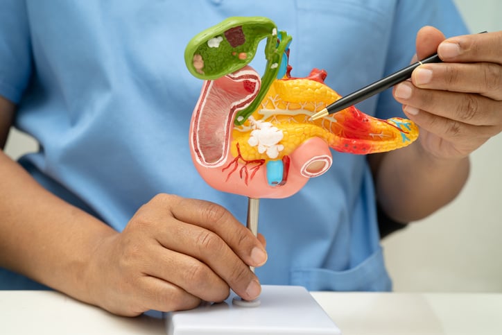 Un vaccino per prevenire le recidive nel tumore del pancreas - Fondazione Umberto Veronesi