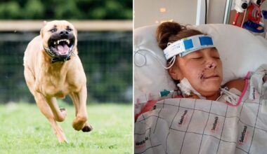 Usa, donna aggredita da due pitbull: amputate braccia e gambe