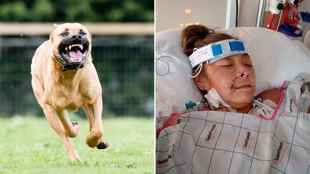Usa, donna aggredita da due pitbull: amputate braccia e gambe