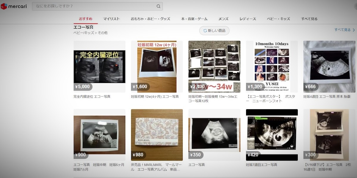 Il principale e-commerce giapponese ha vietato la vendita di ecografie di feti