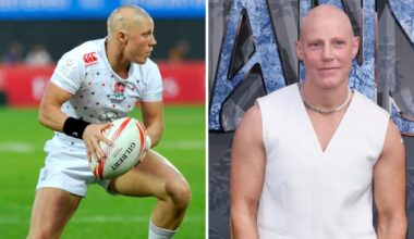 Heather Fisher, ex giocatrice di rugby colpita da alopecia: «Per cinque anni non mi sono guardata allo specchio»