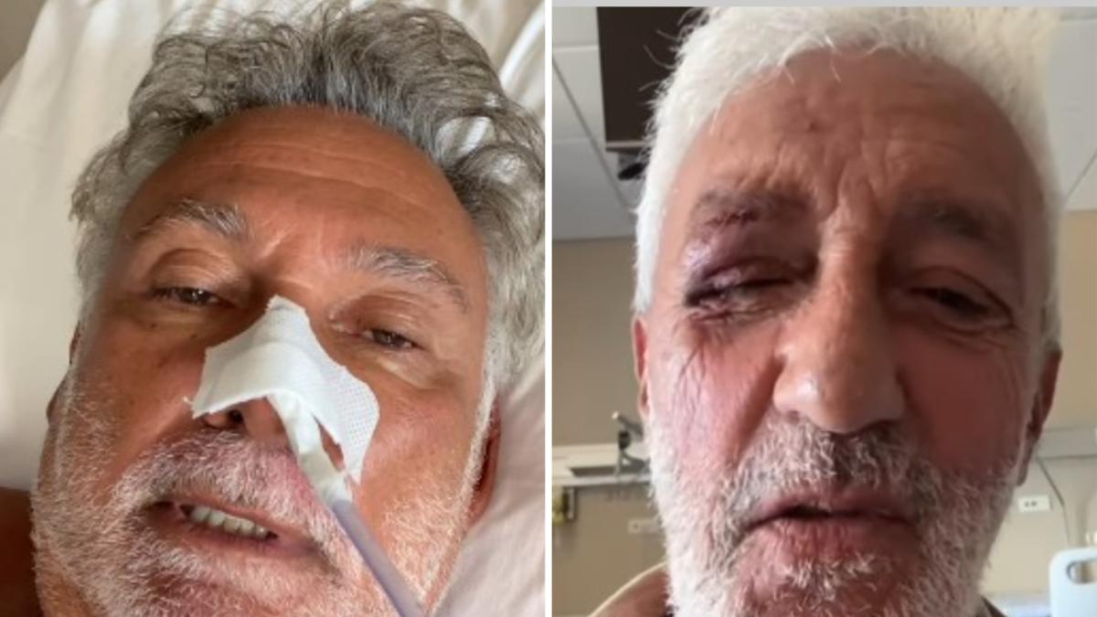 Francesco Paolantoni e Patrizio Rispo ricoverati a Napoli l'uno all'insaputa dell'altro: incontro e video per i fans