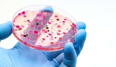Candida auris, Italia al terzo posto in Europa per numero di casi. Che cos'è il «fungo killer» e quali sono i sintomi