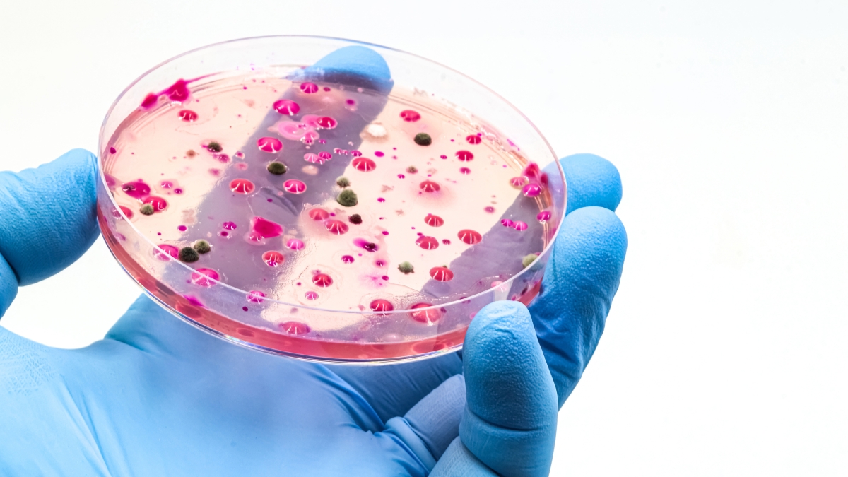 Candida auris, Italia al terzo posto in Europa per numero di casi. Che cos'è il «fungo killer» e quali sono i sintomi