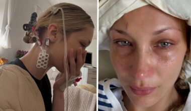 Bella Hadid in ospedale per Malattia di Lyme: le foto shock