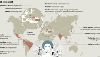 Interventi per allungare gli arti in Turchia. «Mi è costato 29mila euro, ora sono più alto e supero mia moglie»