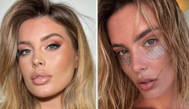 «Da adolescente avevo la dismorfia, mi vergognavo. Il primo filler a 16 anni, ora sono tornata naturale»