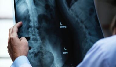 Trento, infermieri di triage potranno richiedere in autonomia radiografie per traumi minori. Il progetto sperimentale
