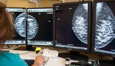 Mammografia ed ecografia gratuita per la prevenzione del tumore al seno