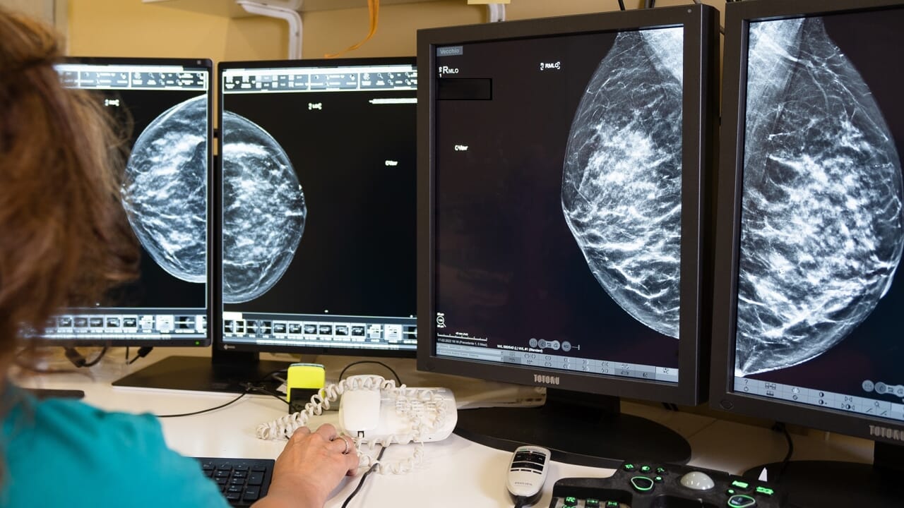 Mammografia ed ecografia gratuita per la prevenzione del tumore al seno