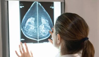 Fiumefreddo Bruzio, screening gratuiti per il tumore al seno dal 12 al 15 settembre