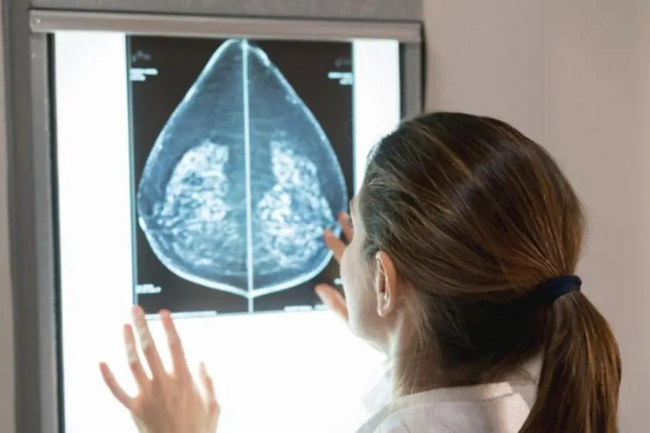 Fiumefreddo Bruzio, screening gratuiti per il tumore al seno dal 12 al 15 settembre