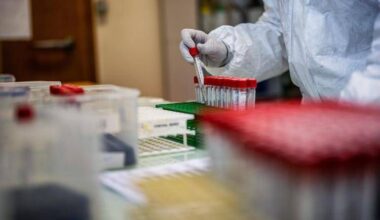 Covid in Italia, avanza variante Stratus: sintomi e contagi