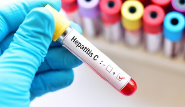 Trapianti: sì all’utilizzo di organi da donatori con Epatite C su riceventi negativi