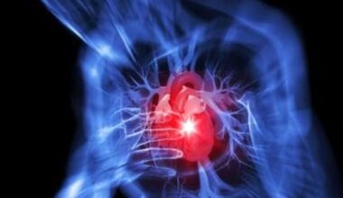A Roma est ci sono 145 mila persone a rischio infarto