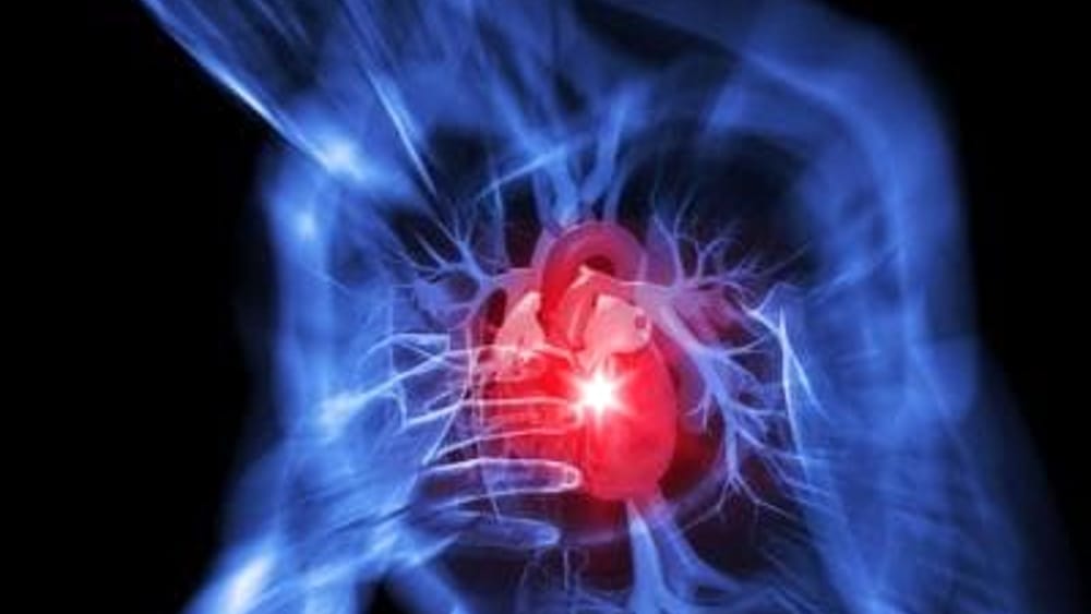 A Roma est ci sono 145 mila persone a rischio infarto