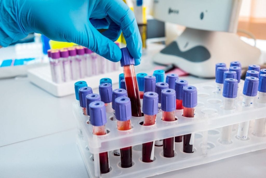 La protesta dei laboratori di analisi mediche – ReteIblea