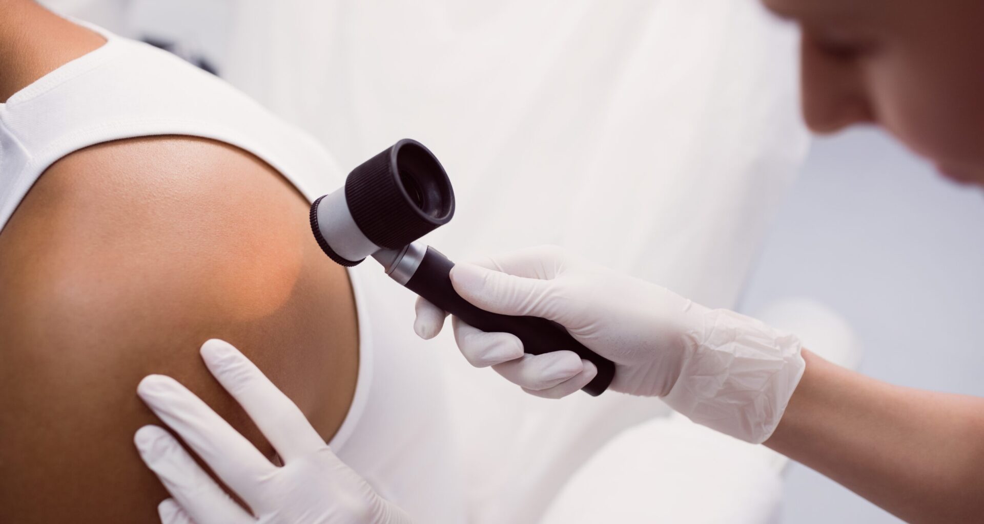 Melanoma, casi raddoppiati in 20 anni: da 6.000 a 15.000 diagnosi l’anno