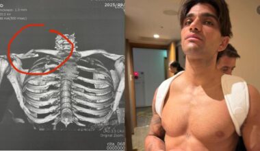 MotoGP 2025. GP del Giappone. Le prime parole di Jorge Martin dopo l’incidente: “Fa male, ma non mollo” - MotoGP