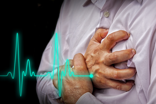 Infarto: farmaci e prevenzione riducono la mortalità fino al 3%. Lo studio italiano