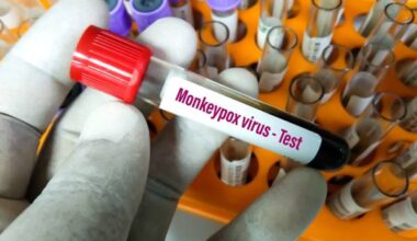 Mpox non è più un’emergenza sanitaria di interesse internazionale
