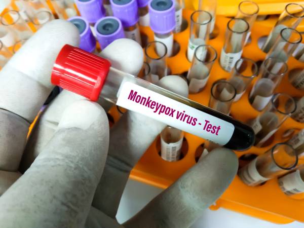 Mpox non è più un’emergenza sanitaria di interesse internazionale