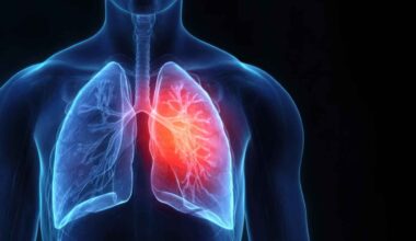 il ruolo del microbiota nella gravità delle infezioni respiratorie