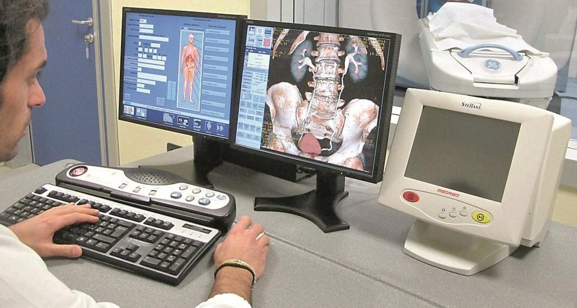 Sette anni di dolori prima di una diagnosi, il calvario degli 800mila piemontesi con malattie reumatiche