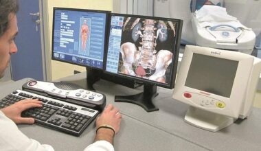 Sette anni di dolori prima di una diagnosi, il calvario degli 800mila piemontesi con malattie reumatiche