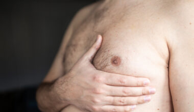 Uomo con tumore al seno