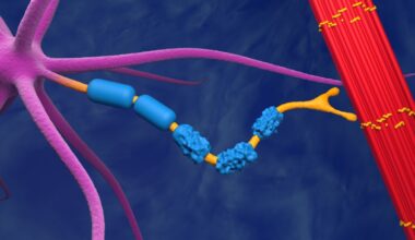 La SLA potrebbe essere una malattia autoimmune: una scoperta che cambia prospettiva nelle cure
