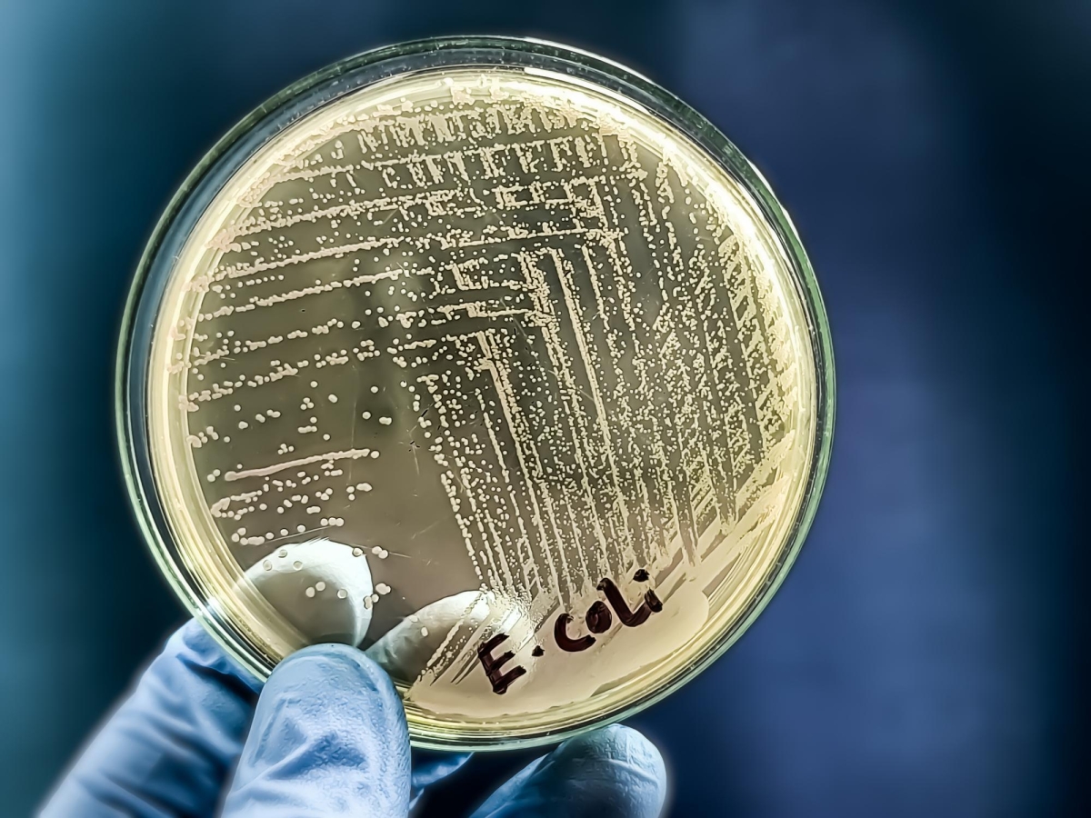 Escherichia coli e Klebsiella pneumonia sono i batteri più cattivi. L'Oms lancia l'allarme sull'antibiotico-resistenza