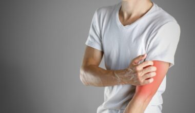 Scabbia, cos'è l'infestazione della pelle causata da un acaro e perché i casi sono in aumento (anche in Italia)