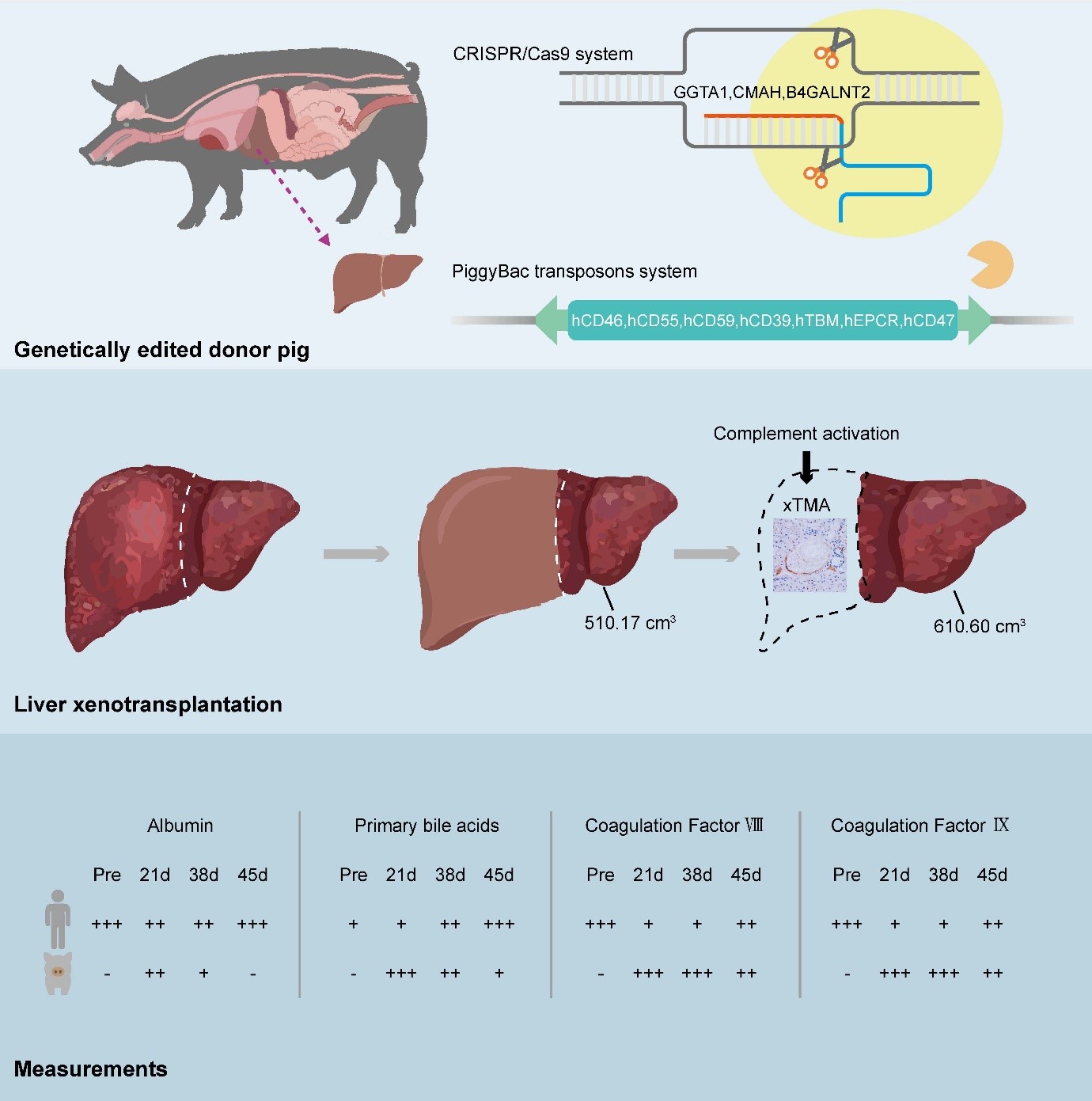 A landmark study in the Journal of Hepatology reports the world’s first auxiliary liver xenotransplant from a genetically engineered pig to a living human recipient.