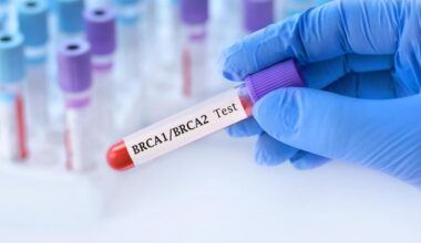 Tumore alla prostata metastatico e con mutazione dei geni BRCA: una nuova cura rallenta l'avanzata della malattia