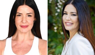 «Le mie labbra rovinate da un filler sbagliato. Ho paura degli aghi, sto rimuovendo il silicone con il laser»