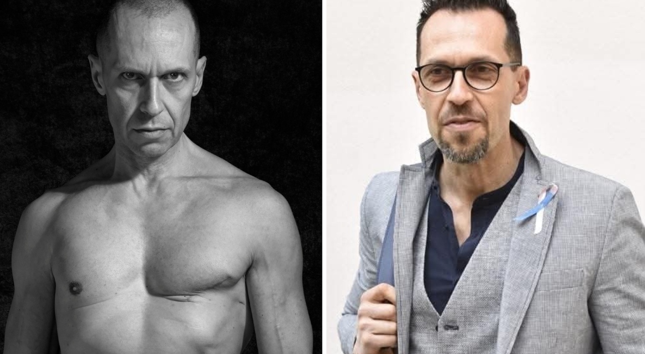 «Non sapevo nemmeno di avere un seno, poi ho scoperto il cancro. Mi chiedevo Perché a me che sono uomo?, oggi non nascondo più la cicatrice»