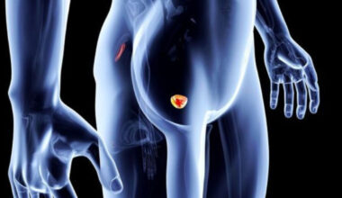 Cancro alla prostata, il Dna può ​svelare basso o alto rischio: il nuovo studio