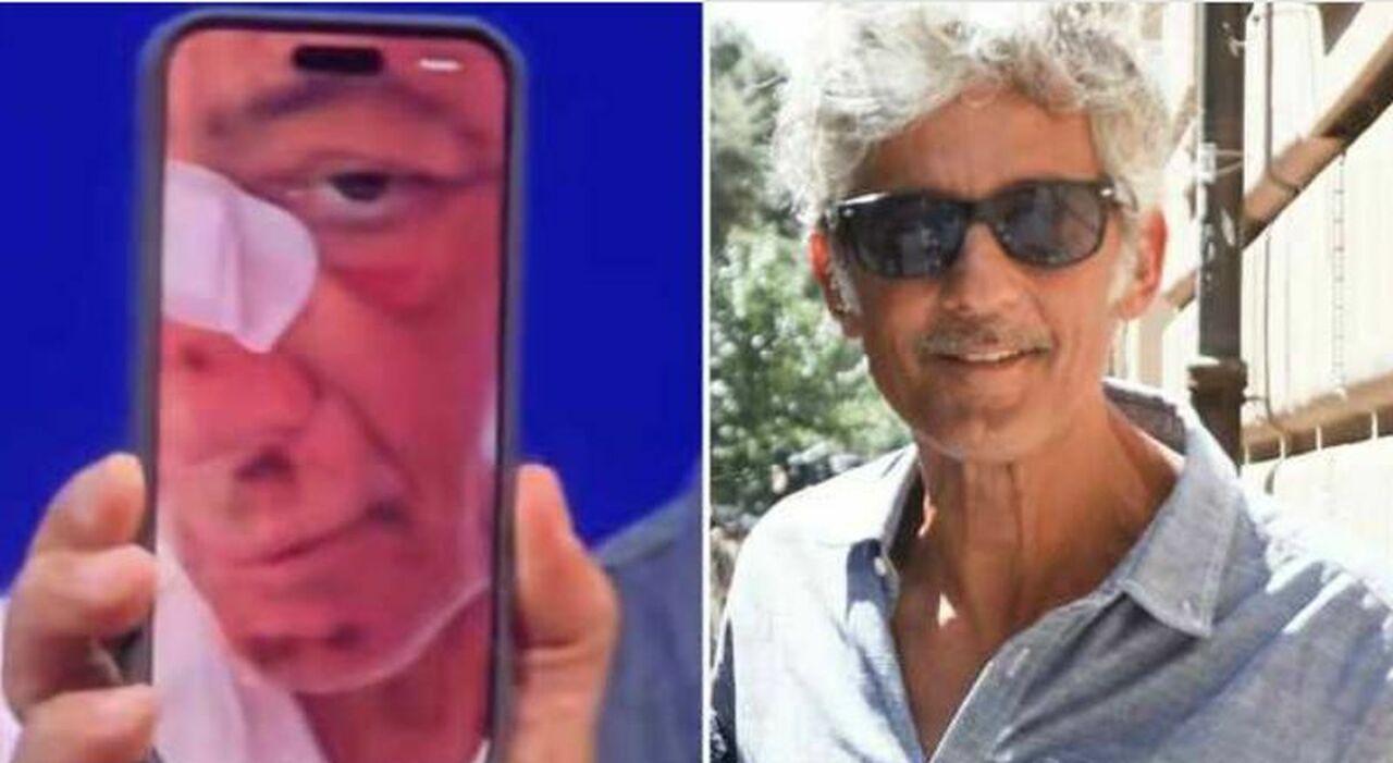 «Sono caduto di faccia, ero conciato malissimo. Mi hanno soccorso tre operai»