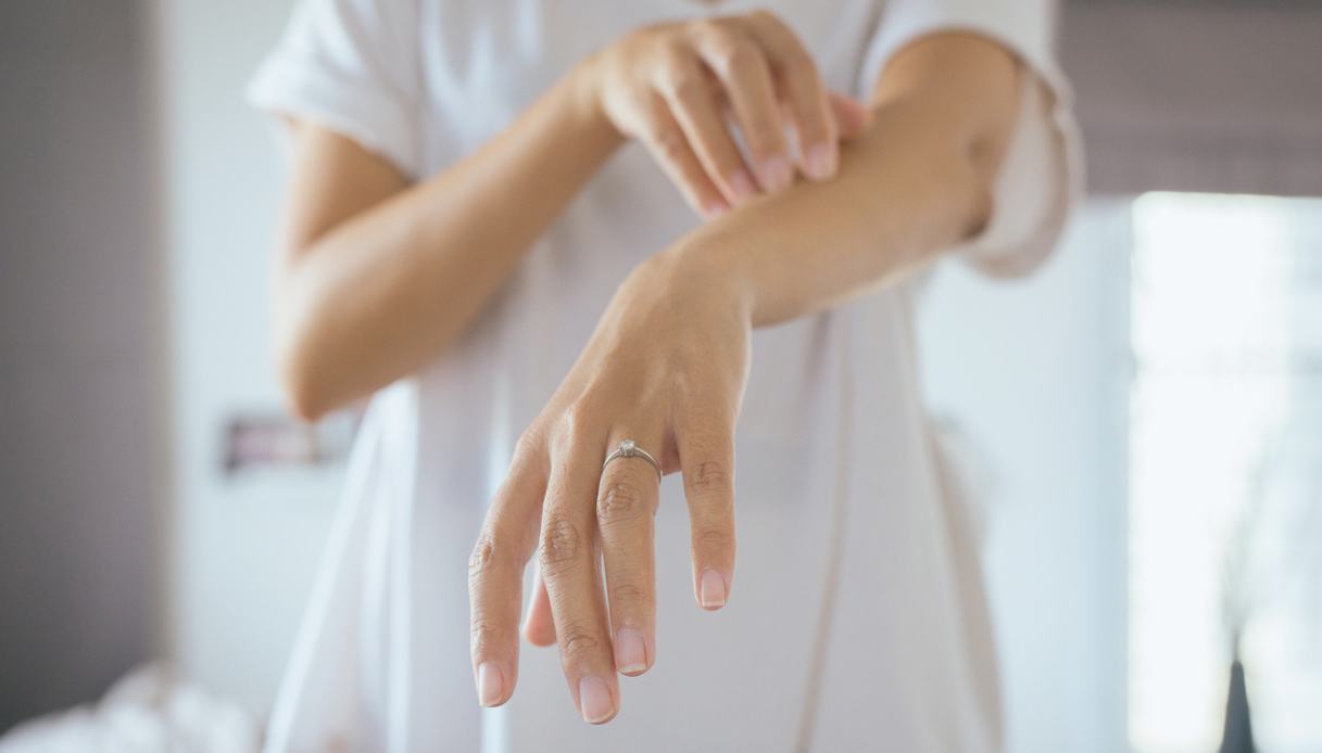 Psoriasi: le migliori creme e i trattamenti più efficaci per un sollievo immediato e duraturo